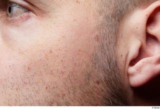  HD Face Skin Raul Conley cheek face skin pores skin texture 0004.jpg